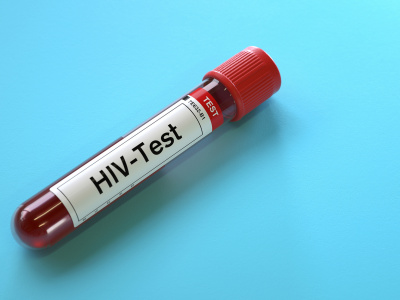 Blood sample for hiv virus test,3d rendering,conceptual image